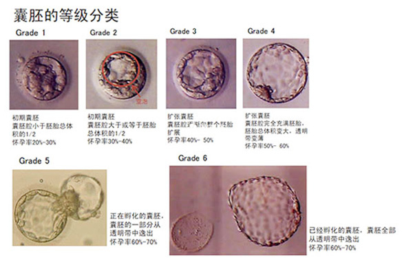 囊胚的等级分类