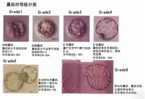 囊胚的等级分类