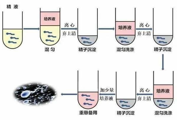 HIV洗精术详细操作