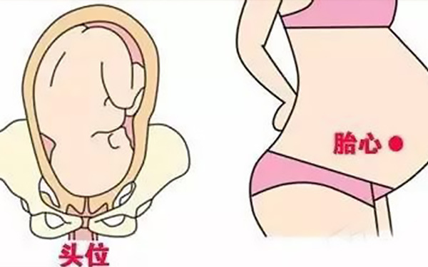 胎心位置与胎位图解