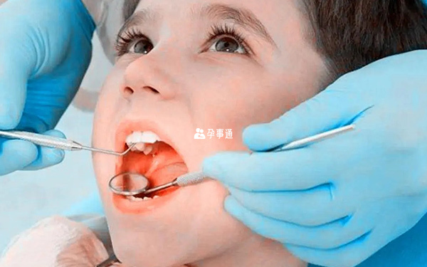 不同儿童换牙时间有差异