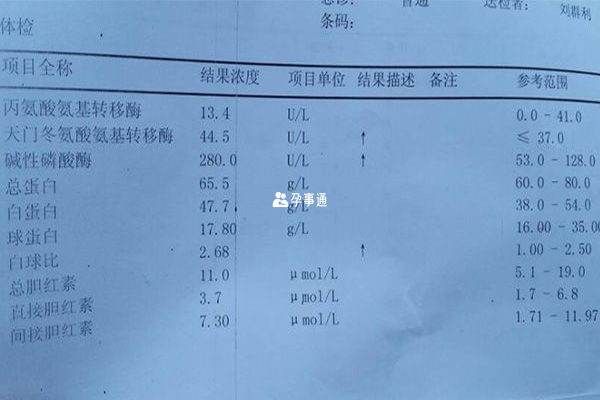 肝功能检查报告单图片