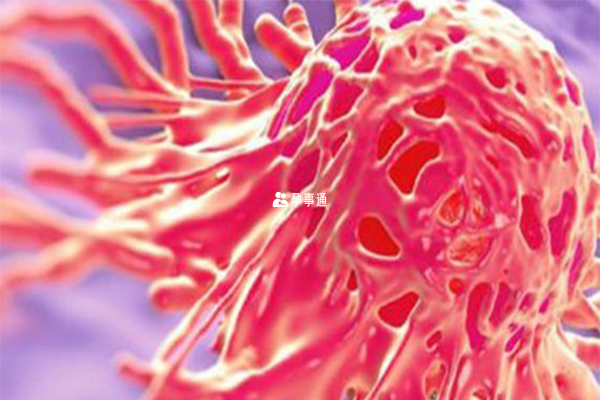 宫颈抹片HPV阳性可能会导致子宫颈癌
