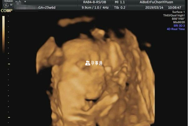 侧面图像可观察胎儿脊柱发育情况
