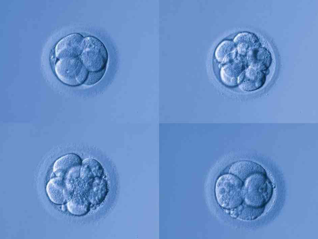 胚胎等级划分