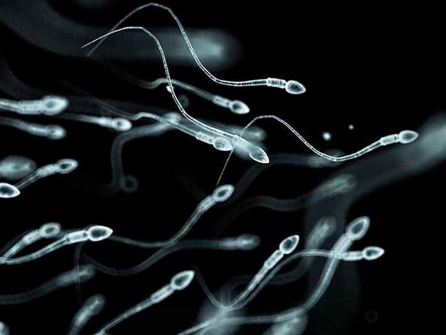 精子DNA碎片率