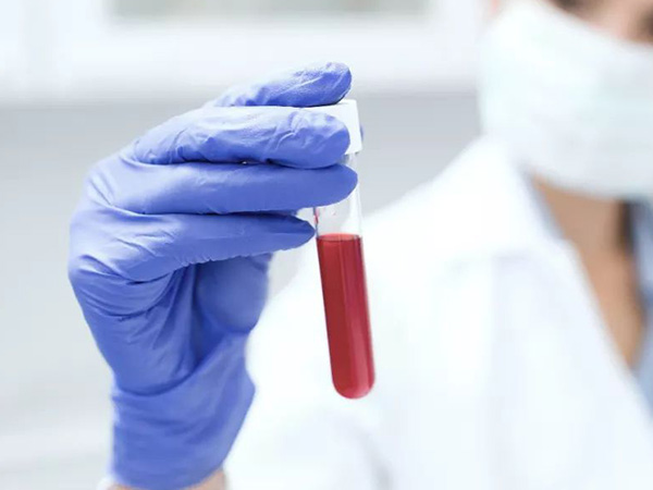 ABO血型检测不出孟买血型