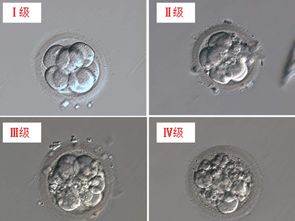 不同级别胚胎养囊成功率不一样