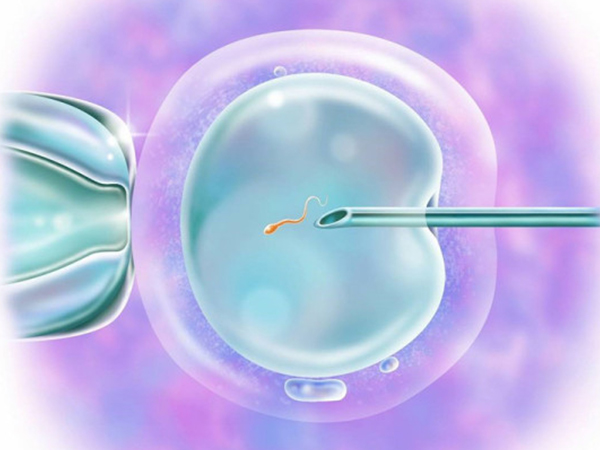 二代试管技术就是单精子显微注射技术