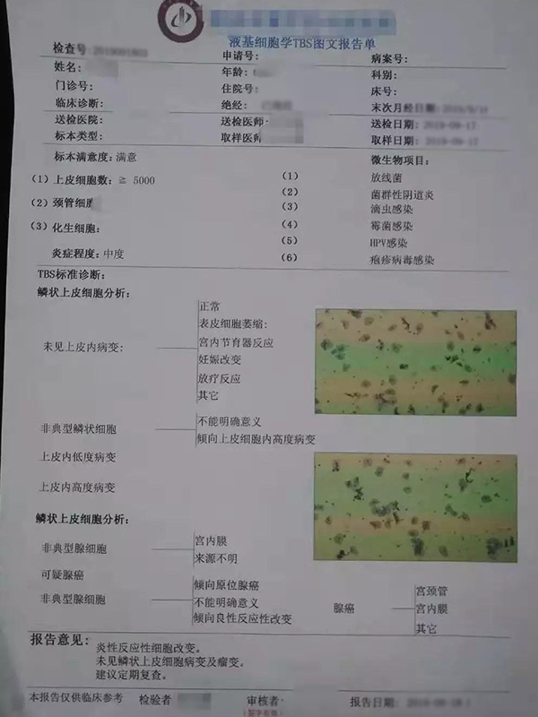 tct检查报告单