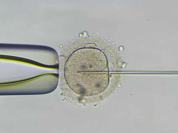 icsi二代试管不会进行PGD筛查