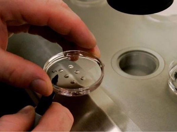优质胚胎染色体异常会导致养囊失败