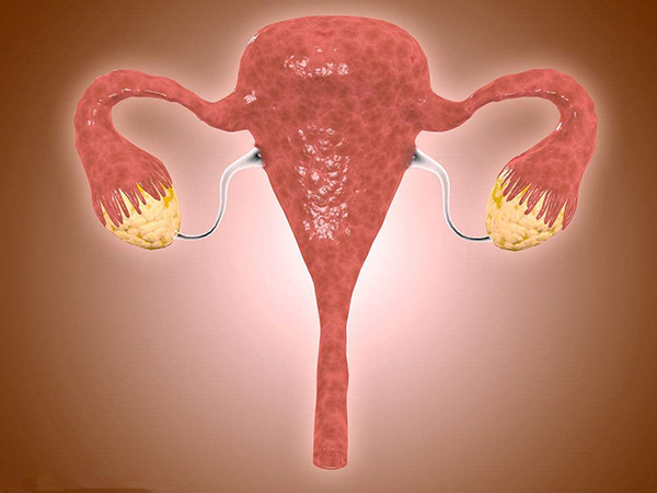 黄体期促排适合卵巢功能好的患者