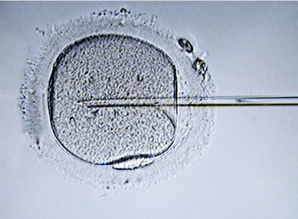 囊胚移植的成功率有60%以上