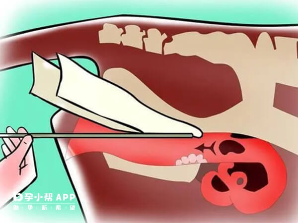 人工授精部位有宫腔、阴道、输卵管等