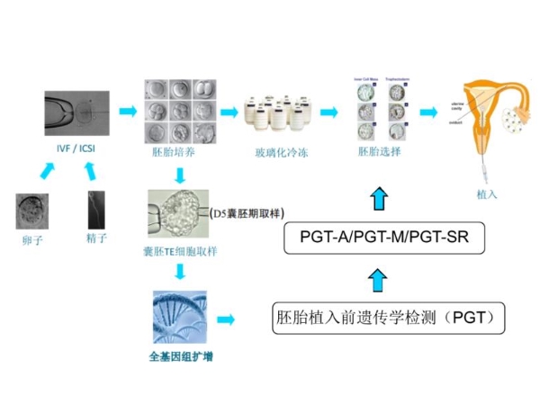 染色体异常可以做三代试管