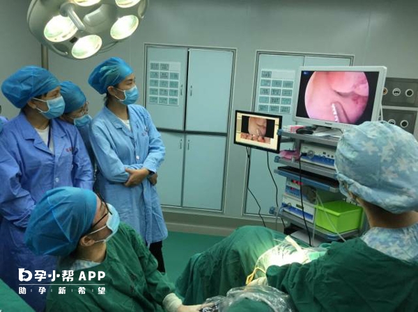 治疗宫腔粘连的方法