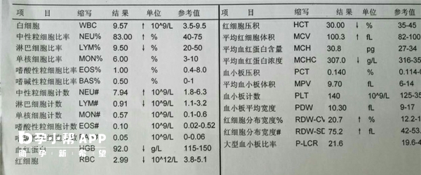 地贫的血常规特点