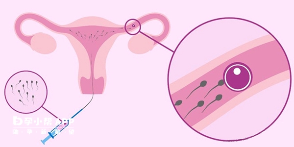 人工授精不能选性别