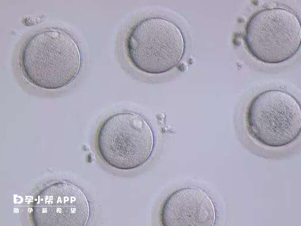 杭州公立医院申请供卵需要等待较长时间