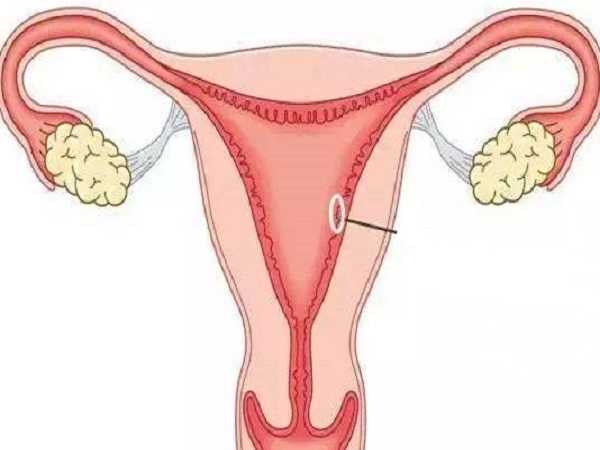 子宫内膜薄可以怀孕