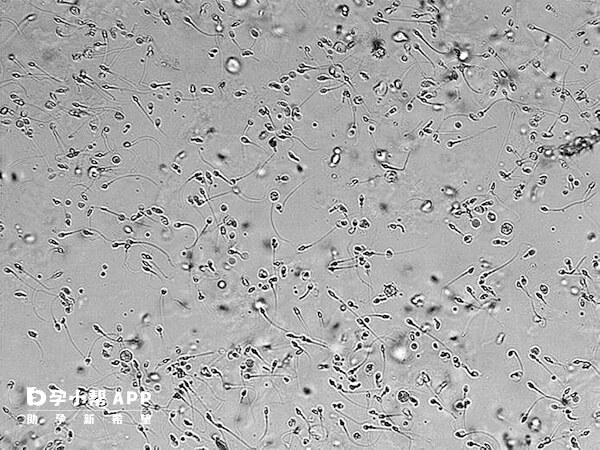 正常男性精子畸形率在百分之九十六以下