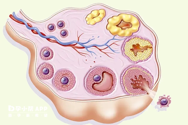 排卵障碍会影响到怀孕