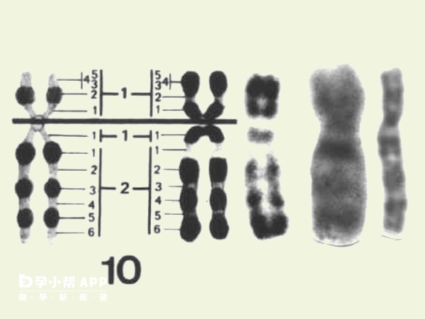 10号染色体