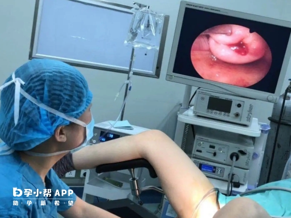 宫腔镜分为手术和检查