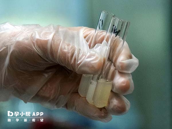 精子碎片率要单独检查