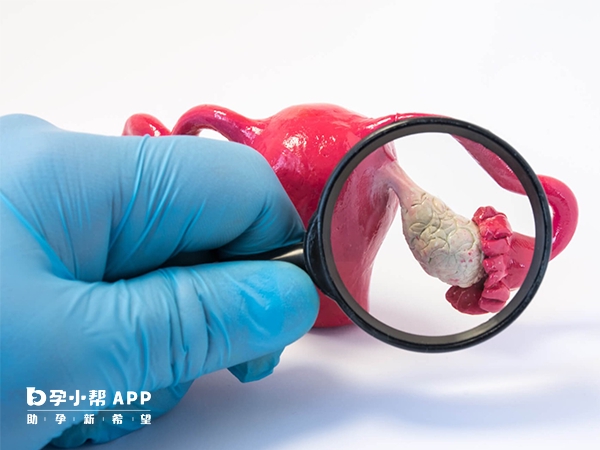 邢台治疗多囊卵巢的医院有很多