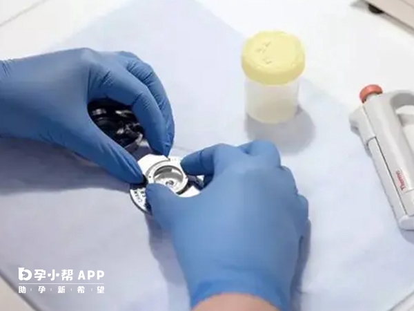 国内并没有医院有开展精子分离术