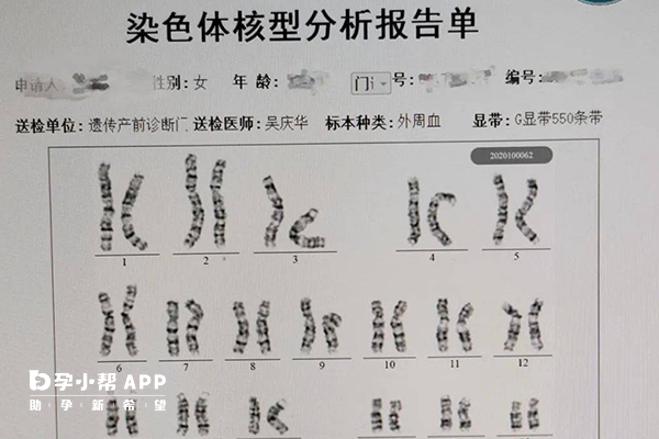 染色体核型分析报告单