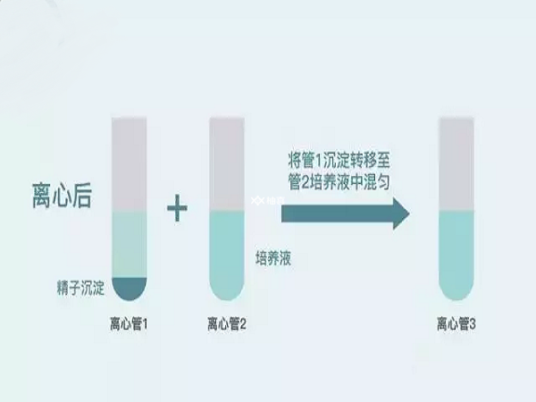 密度梯度离心是试管婴儿中最常用的洗精方法