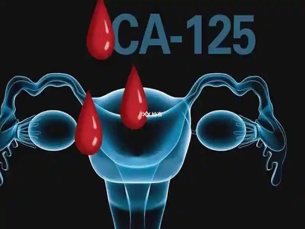 ca125偏高多是疾病导致的