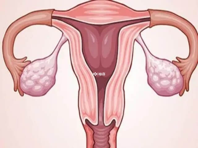 多囊卵巢不能直接进行促排