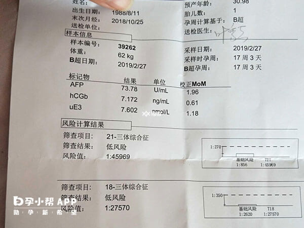 唐筛判断男女没有医学依据