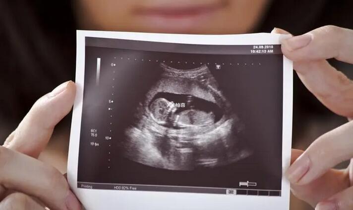 孕晚期怎么辨别胎儿性别
