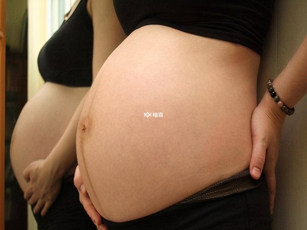 生儿子的妊娠线图片