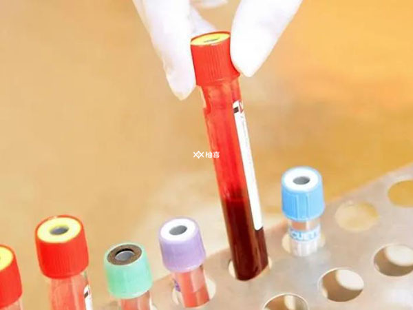 验血未能验出y染色体是什么意思