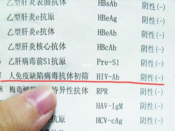 艾滋病检查为什么不给报告单