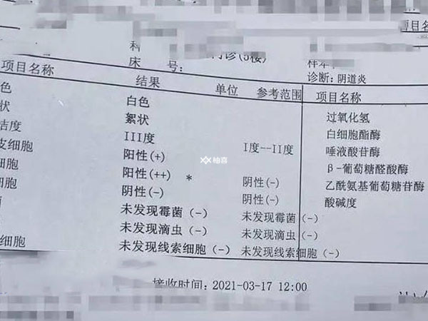 怎样看白带常规报告单