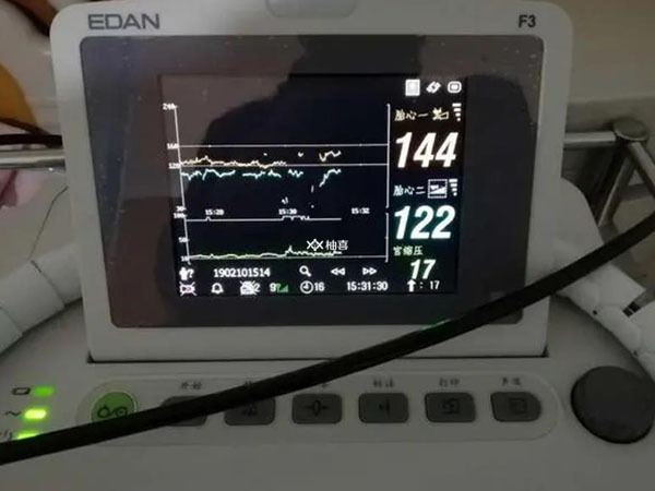 杭州邵逸夫医院四维怎么样