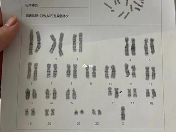 白痴生孩子会不会智商低