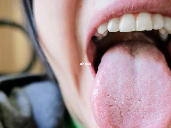 移植后舌苔厚有什么影响