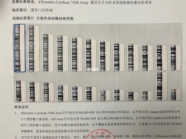 12号染色体微缺失是否致病