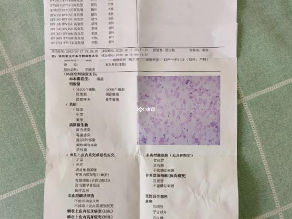 tct检查结果有几种