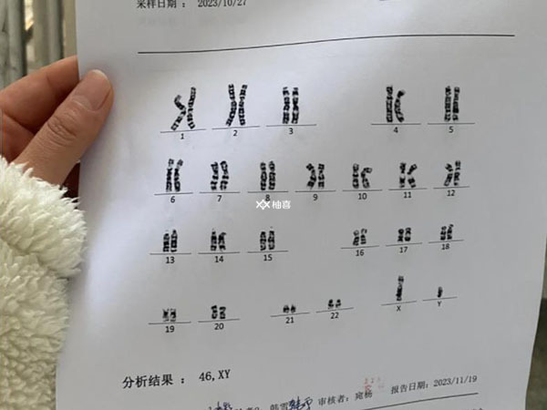 12号染色体缺失会导致什么