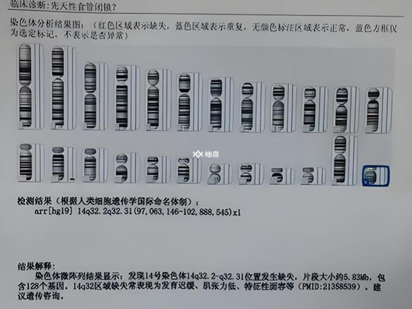 三代试管能避免哪些遗传疾病