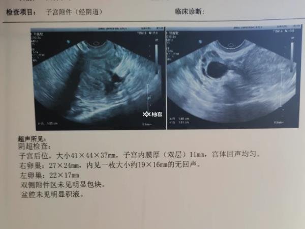 促排卵泡不圆有什么补救方法